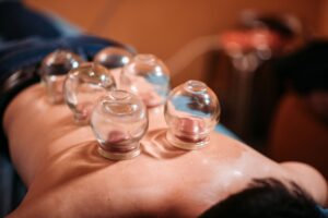 CUPPING THERAPY - VENTOUSES