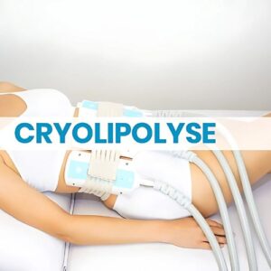 Cryolipolyse